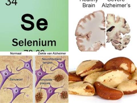 Alzheimer en selenium.jpg