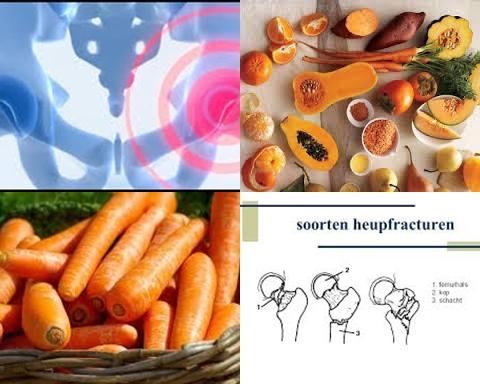 Beta caroteen en heupfracturen.jpg