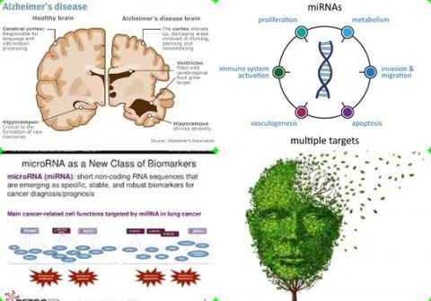 Biomerker en Alzheimer.jpg