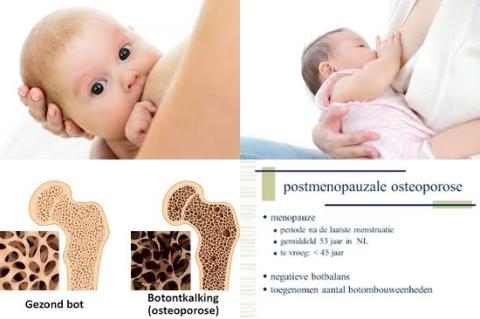 Borstvoeding en botontkalking.jpg