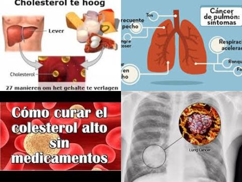 Cholesterol en longkanker.jpg