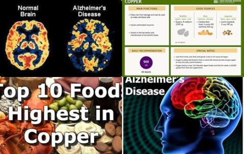 Copper and Alzheimer's disease.jpg