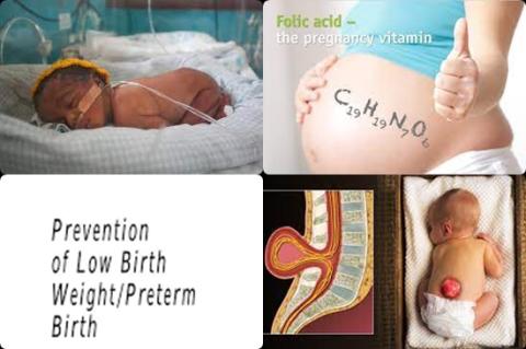 Folic acid and spina bifida.jpg