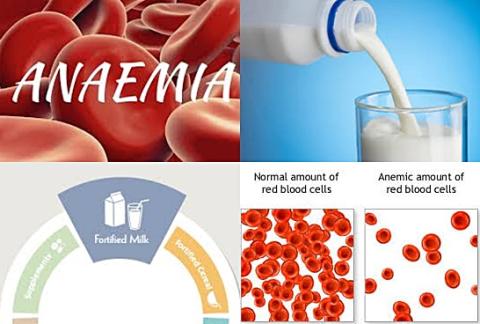 Fortified milk and anemia.jpg