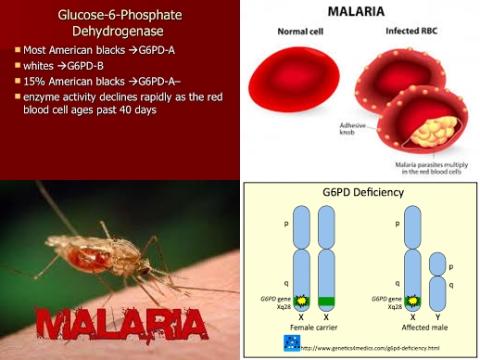 Glucose-6-Phosphate Dehydrogenase deficiency and malaria.jpg