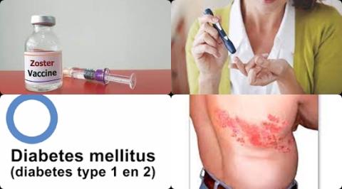 Herpes zoster and diabetes.jpg