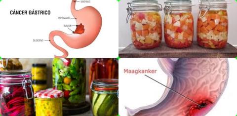 Ingemaakte groente en maagkanker.jpg