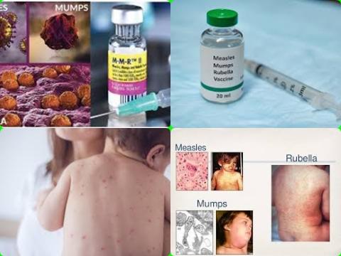 Measles-mumps-rubella (MMR) vaccine.jpg