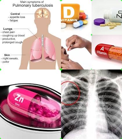 Micronutrient and tuberculosis.jpg