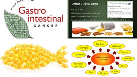 N-3 PUFA and gastrointestinal cancer.jpg