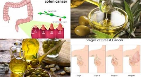 Olive oil and breast cancer.jpg