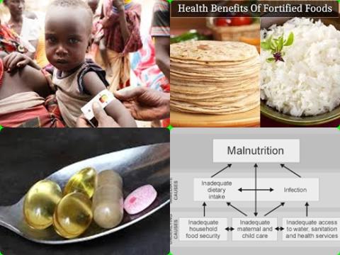 Supplementation and malnutrition.jpg