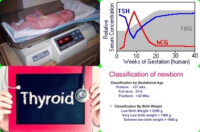 Thyroid and birth weight.jpg