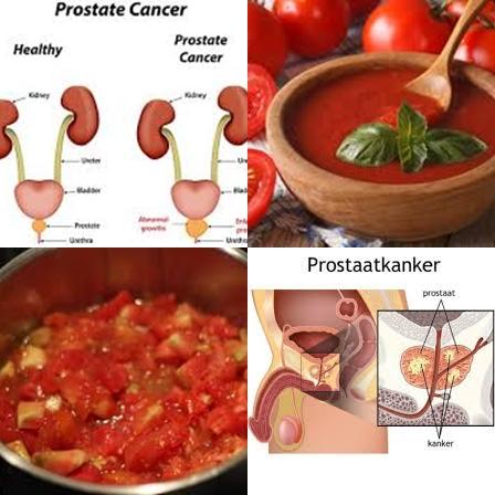 Tomaten en prostaatkanker.jpg