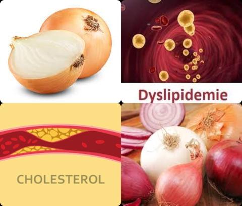 Uien en cholesterol.jpg