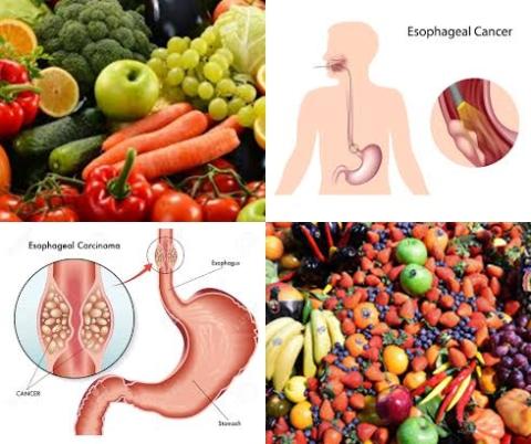 Vegetables and fruit and esophageal squamous cell carcinoma.jpg