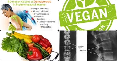 Vegetarisch dieet en osteoporose.jpg