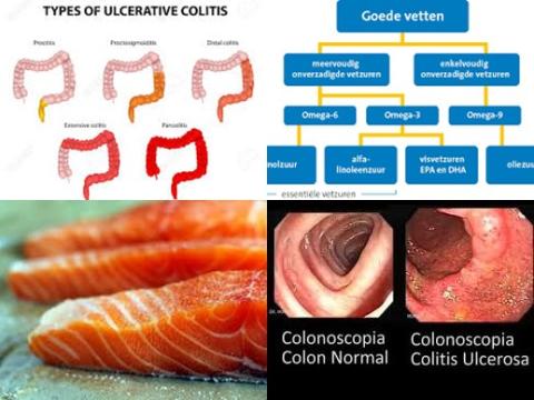 Vet en colitis ulcerosa.jpg