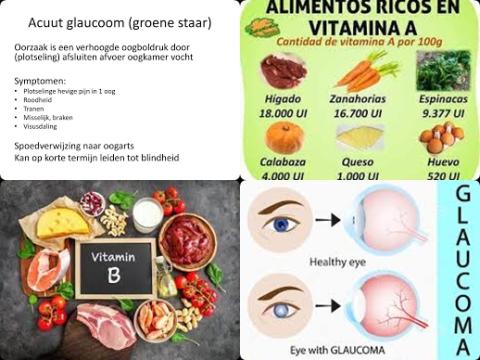 Vitamine A en glaucoom.jpg