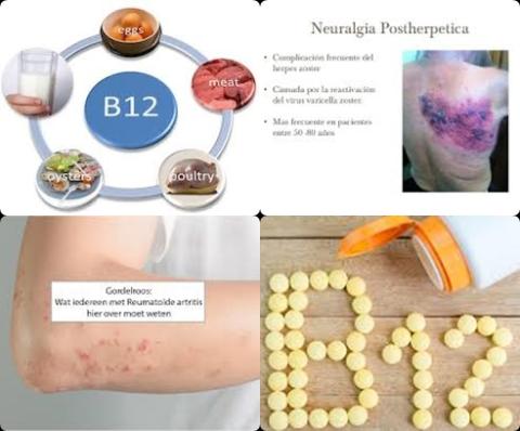Vitamine B12 en gordelroos.jpg