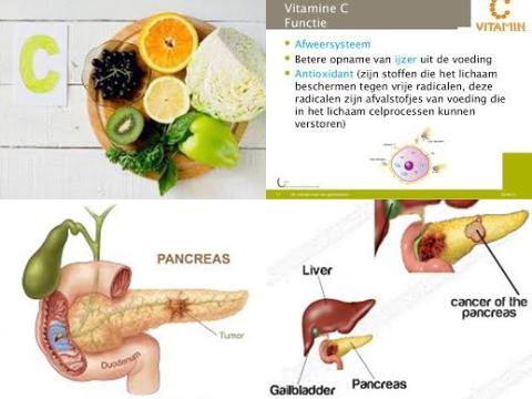 Vitamine C en alvleesklierkanker.jpg