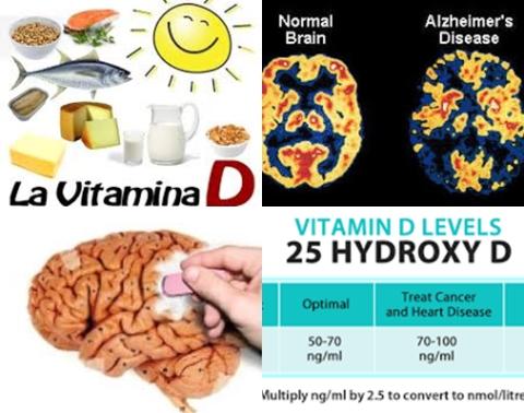Vitamine D en Alzheimer.jpg