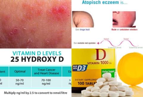 Vitamine D en dermatitis.jpg