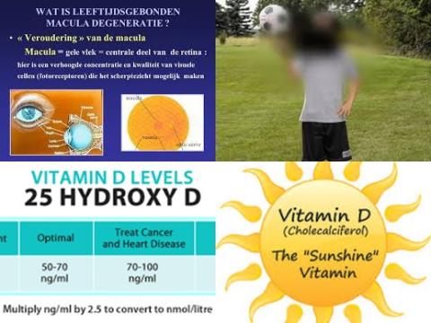 Vitamine D en oogziekte.jpg