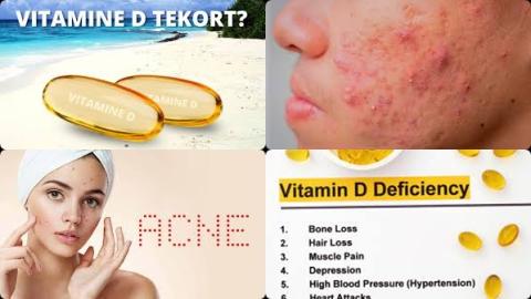 Vitamine D tekort en acne.jpg
