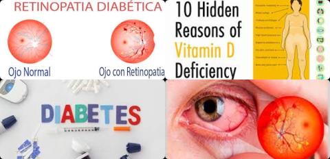 Vitamine D tekort en diabetische retinopathie.jpg
