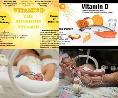 Vitamine D tekort en vroeggeboorte.jpg