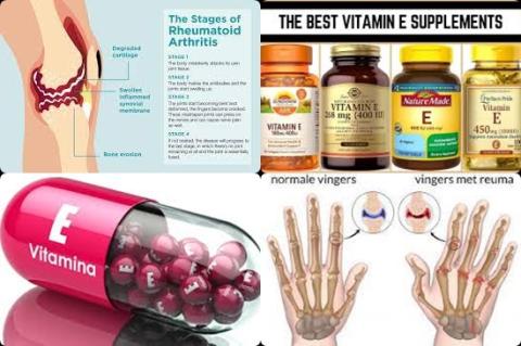 Vitamine E supplementen en reuma.jpg