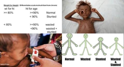 Wasted and stunted.jpg