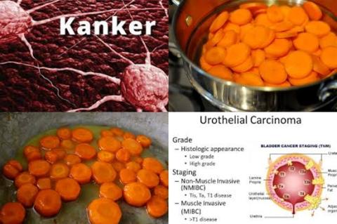 Wortel en urineleiderkanker.jpg