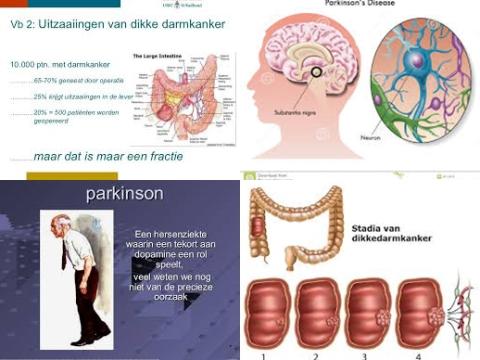 Ziekte van Parkinson en dikke darmkanker.jpg