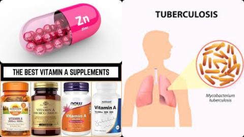 Zinc and tuberculosis.jpg